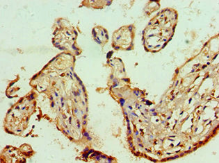 Immunohistochemistry of paraffin-embedded human placenta tissue using ANP32A Antibody at dilution of 1:100Rabbit anti-Human ANP32A Polyclonal Antibody