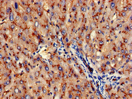 Immunohistochemistry of paraffin-embedded human liver tissue using ANPEP Antibody at dilution of 1:100Rabbit anti-Human ANPEP Polyclonal Antibody