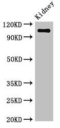 Western Blot  | Positive WB detected in: Mouse kidney tissue  | All lanes: ANPEP antibody at 3.4µg/ml  | Secondary  | Goat polyclonal to rabbit IgG at 1/50000 dilution  | Predicted band size: 110 kDa  | Observed band size: 110 kDaRabbit anti-Human ANPEP Polyclonal Antibody