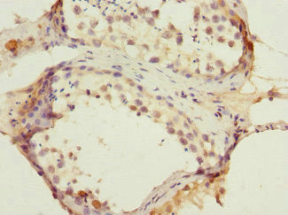 Immunohistochemistry of paraffin-embedded human testis tissue using ANTXR2 Antibody at dilution of 1:100Rabbit anti-Human ANTXR2 Polyclonal Antibody