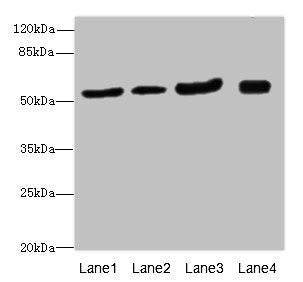 Western blot | All lanes: ANTXR2antibody at 1.24μg/ml | Lane 1: Mouse lung tissue | Lane 2: Mouse gonadal tissue | Lane 3: Mouse kidney tissue | Lane 4: Mouse small intestine tissue | Secondary | Goat polyclonal to rabbit IgG at 1/10000 dilution | Predicted band size: 54, 43, 35 kDa | Observed band size: 54 kDaRabbit anti-Human ANTXR2 Polyclonal Antibody