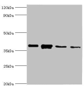 Western blot  | All lanes: Anxa1 antibody at 2µg/ml  | Lane 1: PC-3 whole cell lysate  | Lane 2: A431 whole cell lysate  | Lane 3: K562 whole cell lysate  | Lane 4: MCF-7 whole cell lysate  | Secondary  | Goat polyclonal to rabbit IgG at 1/10000 dilution  | Predicted band size: 39 kDa  | Observed band size: 39 kDaRabbit anti-Mus musculus (Mouse) Anxa1 Polyclonal Antibody