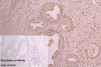 Immunohistochemistry of paraffin-embedded human kidney tissue using ANXA11 Antibody at dilution of 1:100Rabbit anti-Human ANXA11 Polyclonal Antibody