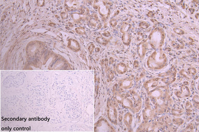 Immunohistochemistry of paraffin-embedded human placenta tissue using ANXA11 Antibody at dilution of 1:100Rabbit anti-Human ANXA11 Polyclonal Antibody