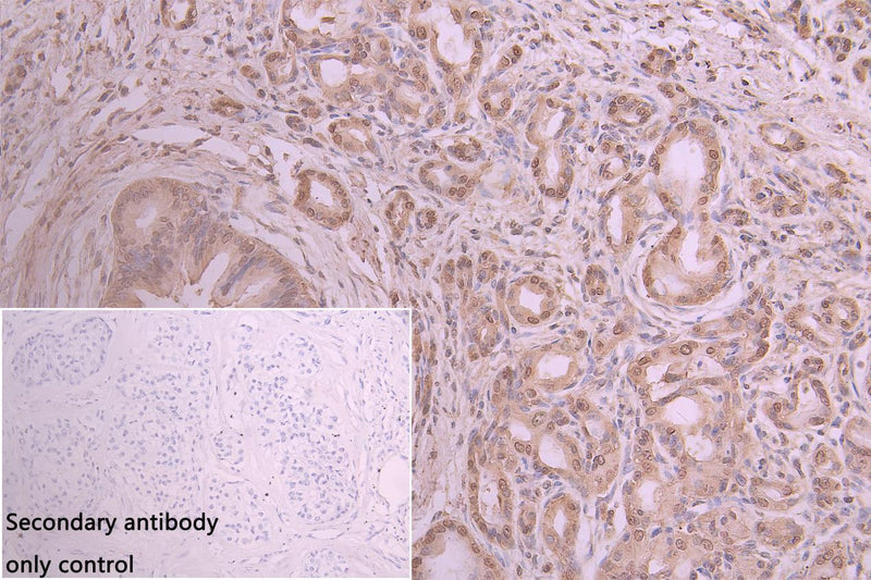Immunohistochemistry of paraffin-embedded human placenta tissue using ANXA11 Antibody at dilution of 1:100Rabbit anti-Human ANXA11 Polyclonal Antibody