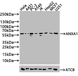 Western blot  | All lanes: Annexin A11 antibody at 14μg/ml + U251 whole cell lysate  | Secondary  | Goat polyclonal to rabbit IgG at 1/10000 dilution  | Predicted band size: 55, 52 kDa  | Observed band size: 52 kDaRabbit anti-Human ANXA11 Polyclonal Antibody