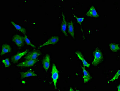 Immunofluorescent analysis of Hela cells using ANXA2 Antibody at dilution of 1:100 and Alexa Fluor 488-congugated AffiniPure Goat Anti-Rabbit IgG(H+L)Rabbit anti-Human ANXA2 Polyclonal Antibody
