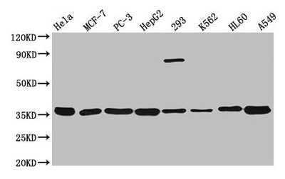 Western Blot  | Positive WB detected in: Hela whole cell lysate, MCF-7 whole cell lysate, PC-3 whole cell lysate, HepG2 whole cell lysate, 293 whole cell lysate, K562 whole cell lysate, HL60 whole cell lysate, A549 whole cell lysate  | All lanes: ANXA5 antibody at 1:3000  | Secondary  | Goat polyclonal to rabbit IgG at 1/50000 dilution  | Predicted band size: 36 kDa  | Observed band size: 36 kDaRabbit anti-Human ANXA5 Polyclonal Antibody