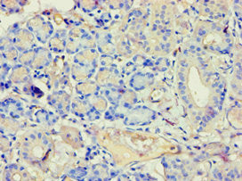 Immunohistochemistry of paraffin-embedded human pancreatic tissue using ANXA7 Antibody at dilution of 1:100Rabbit anti-Human ANXA7 Polyclonal Antibody