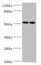Western blot  | All lanes: Annexin A7 antibody at 4µg/ml  | Lane 1: Jurkat whole cell lysate  | Lane 2: LO2 whole cell lysate  | Secondary  | Goat polyclonal to rabbit at 1/10000 dilution  | Predicted band size: 53, 51 kDa  | Observed band size: 53 kDaRabbit anti-Human ANXA7 Polyclonal Antibody