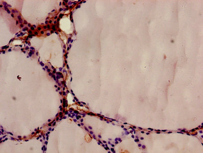 Immunohistochemistry of paraffin-embedded human thyroid tissue using ANXA9 Antibody at dilution of 1:100Rabbit anti-Human ANXA9 Polyclonal Antibody