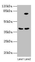 Western blot  | All lanes: ANXA9 antibody at 8µg/ml  | Lane 1: Mouse kidney tissue  | Lane 2: A431 whole cell lysate  | Secondary  | Goat polyclonal to rabbit IgG at 1/10000 dilution  | Predicted band size: 39 kDa  | Observed band size: 39 kDaRabbit anti-Human ANXA9 Polyclonal Antibody