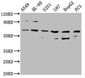 Western Blot | Positive WB detected in: A549 whole cell lysate, HL60 whole cell lysate, U251 whole cell lysate, U87 whole cell lysate, HepG2 whole cell lysate, PC-3 whole cell lysate | All lanes: AOAH antibody at 1:2000 | Secondary | Goat polyclonal to rabbit IgG at 1/50000 dilution | Predicted band size: 66, 62 kDa | Observed band size: 66 kDaRabbit anti-Human AOAH Polyclonal Antibody