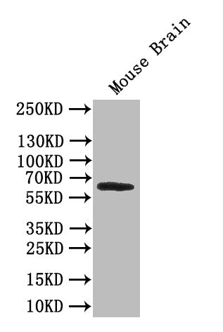 Western Blot | Positive WB detected in: A549 whole cell lysate, Mouse skeletal muscle tissue, Rat lung tissue | All lanes: AOAH antibody at 2.5μg/ml | Secondary | Goat polyclonal to rabbit IgG at 1/50000 dilution | Predicted band size: 66, 62 kDa | Observed band size: 66 kDaRabbit anti-Human AOAH Polyclonal Antibody