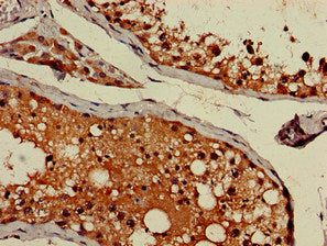 Immunohistochemistry of paraffin-embedded human testis tissue using AP1G1 Antibody at dilution of 1:100Rabbit anti-Human AP1G1 Polyclonal Antibody