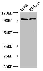 Western Blot  | Positive WB detected in:K562 whole cell lysate,Mouse kidney tissue  | All lanes:AP1G1 antibody at 3.4µg/ml  | Secondary  | Goat polyclonal to rabbit IgG at 1/50000 dilution  | Predicted band size: 92 KDa  | Observed band size: 92 KDaRabbit anti-Human AP1G1 Polyclonal Antibody
