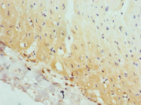 Immunohistochemistry of paraffin-embedded human heart tissue using AP2A2 Antibody at dilution of 1:100Rabbit anti-Human AP2A2 Polyclonal Antibody