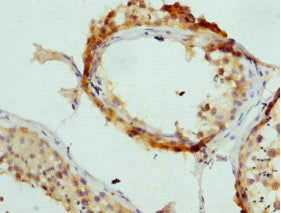 Immunohistochemistry of paraffin-embedded human testis tissue using AP2A2 Antibody at dilution of 1:100Rabbit anti-Human AP2A2 Polyclonal Antibody
