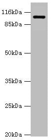 Western blot | All lanes: AP2A2 antibody at 0.61μg/ml + Mouse brain tissue | Secondary | Goat polyclonal to rabbit IgG at 1/10000 dilution | Predicted band size: 104, 105, 74 kDa | Observed band size: 104 kDaRabbit anti-Human AP2A2 Polyclonal Antibody