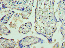 Immunohistochemistry of paraffin-embedded human placenta tissue using AP2B1 Antibody at dilution of 1:100Rabbit anti-Human AP2B1 Polyclonal Antibody