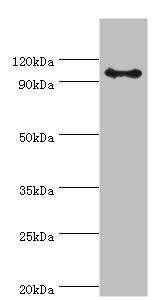 Western blot | All lanes: AP-2 complex subunit beta antibody at 8μg/ml + Mouse brain tissue | Secondary | Goat polyclonal to rabbit IgG at 1/10000 dilution | Predicted band size: 105, 106, 99 kDa | Observed band size: 105 kDaRabbit anti-Human AP2B1 Polyclonal Antibody