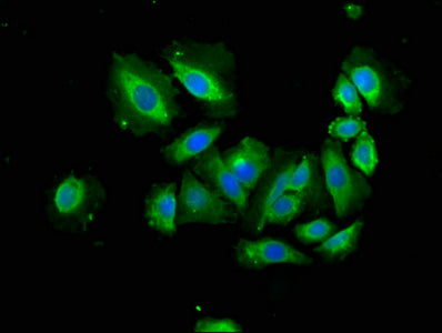 Immunofluorescence staining of A549 cells with APAF1 Antibody at 1:166, counter-stained with DAPI. The cells were fixed in 4% formaldehyde, permeabilized using 0.2% Triton X-100 and blocked in 10% normal Goat Serum. The cells were then incubated with the antibody overnight at 4°C. The secondary antibody was Alexa Fluor 488-congugated AffiniPure Goat Anti-Rabbit IgG(H+L).Rabbit anti-Human APAF1 Polyclonal Antibody