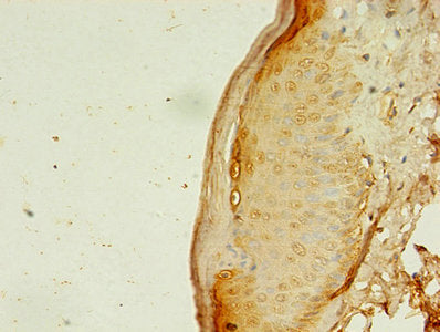 Immunohistochemistry of paraffin-embedded human skin tissue using the antibody at dilution of 1:100Rabbit anti-Human APAF1 Polyclonal Antibody
