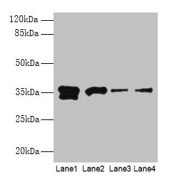 Western blot  | All lanes: APEX1 antibody at 2µg/ml  | Lane 1: Hela whole cell lysate  | Lane 2: Mouse brain tissue  | Lane 3: MCF-7 whole cell lysate  | Lane 4: A431 whole cell lysate  | Secondary  | Goat polyclonal to rabbit IgG at 1/15000 dilution  | Predicted band size: 36 kDa  | Observed band size: 36 kDaRabbit anti-Human APEX1 Polyclonal Antibody