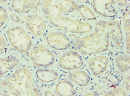 Immunohistochemistry of paraffin-embedded human kidney tissue using APOL1 Antibody at dilution of 1:100Rabbit anti-Human APOL1 Polyclonal Antibody