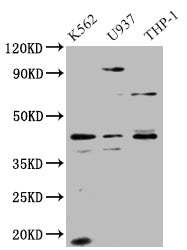 Western BlotPositive WB detected in: K562 whole cell lysate, U937 whole cell lysate, THP-1 whole cell lysateAll lanes: APOL1 antibody at 1:1000SecondaryGoat polyclonal to rabbit IgG at 1/50000 dilutionPredicted band size: 44, 46, 43 kDaObserved band size: 44 kDaRabbit anti-Human APOL1 Polyclonal Antibody