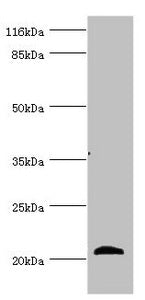 Western blot | All lanes: APOM antibody at 3.93μg/ml + Mouse placenta tissue | Secondary | Goat polyclonal to rabbit IgG at 1/10000 dilution | Predicted band size: 22, 14 kDa | Observed band size: 22 kDa