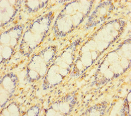 Immunohistochemistry of paraffin-embedded human colon tissue using APOOL Antibody at dilution of 1:100