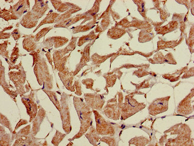 Immunohistochemistry of paraffin-embedded human heart tissue using APOOL Antibody at dilution of 1:100