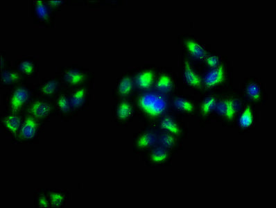 Immunofluorescence staining of Hela cells with the antibody at 1:133, counter-stained with DAPI. The cells were fixed in 4% formaldehyde, permeabilized using 0.2% Triton X-100 and blocked in 10% normal Goat Serum. The cells were then incubated with the antibody overnight at 4°C. The secondary antibody was Alexa Fluor 488-congugated AffiniPure Goat Anti-Rabbit IgG(H+L).Rabbit anti-Human APP Polyclonal Antibody
