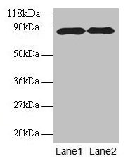Western blot  | All lanes: APP antibody at 2µg/ml  | Lane 1: HL60 whole cell lysate  | Lane 2: Mouse kidney tissue  | Secondary  | Goat polyclonal to rabbit IgG at 1/10000 dilution  | Predicted band size: 87, 35, 77, 79, 81, 83, 85, 86, 73 kDa  | Observed band size: 87 kDaRabbit anti-Human APP Polyclonal Antibody