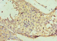 Immunohistochemistry of paraffin-embedded human testis tissue using NAA10 Antibody at dilution of 1:100Rabbit anti-Human NAA10 Polyclonal Antibody