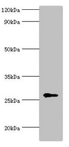 Western blot | All lanes: N-alpha-acetyltransferase 10 antibody at 5μg/ml + Hela whole cell lysate | Secondary | Goat polyclonal to rabbit IgG at 1/10000 dilution | Predicted band size: 27, 25 kDa | Observed band size: 27 kDaRabbit anti-Human NAA10 Polyclonal Antibody