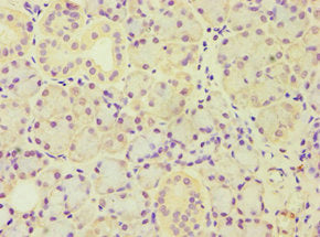 Immunohistochemistry of paraffin-embedded human pancreatic tissue using ARF3 Antibody at dilution of 1:100Rabbit anti-Human ARF3 Polyclonal Antibody