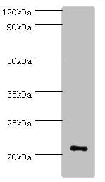 Western blot | All lanes: ARF3 antibody at 6μg/ml + Mouse brain tissue | Secondary | Goat polyclonal to rabbit IgG at 1/10000 dilution | Predicted band size: 21, 17 kDa | Observed band size: 21 kDaRabbit anti-Human ARF3 Polyclonal Antibody