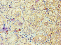 Immunohistochemistry of paraffin-embedded human pancreatic tissue using ARF6 Antibody at dilution of 1:100Rabbit anti-Human ARF6 Polyclonal Antibody