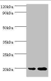 Western blot | All lanes: ARF6 antibody at 2μg/ml | Lane 1: 293T whole cell lysate | Lane 2: HepG2 whole cell lysate | Secondary | Goat polyclonal to rabbit IgG at 1/10000 dilution | Predicted band size: 20 kDa | Observed band size: 20 kDaRabbit anti-Human ARF6 Polyclonal Antibody