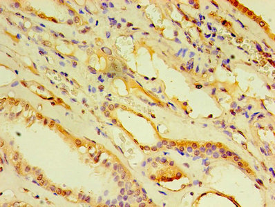 Immunohistochemistry of paraffin-embedded human kidney tissue using ARF6 Antibody at dilution of 1:100Rabbit anti-Human ARF6 Polyclonal Antibody