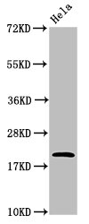 Western Blot  | Positive WB detected in: Hela whole cell lysate  | All lanes: ARF6 antibody at 4.8µg/ml  | Secondary  | Goat polyclonal to rabbit IgG at 1/50000 dilution  | Predicted band size: 21 kDa  | Observed band size: 21 kDaRabbit anti-Human ARF6 Polyclonal Antibody