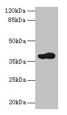 Western blot  | All lanes: ARFIP2 antibody at 2µg/ml + Mouse brain tissue  | Secondary  | Goat polyclonal to rabbit IgG at 1/10000 dilution  | Predicted band size: 38, 30, 34 kDa  | Observed band size: 38 kDaRabbit anti-Human ARFIP2 Polyclonal Antibody