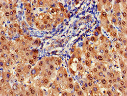 Immunohistochemistry of paraffin-embedded human liver tissue using ARG1 Antibody at dilution of 1:100Rabbit anti-Human ARG1 Polyclonal Antibody