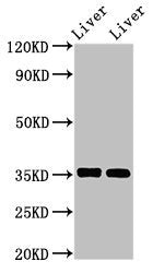 Western Blot  | Positive WB detected in: Mouse liver tissue, Rat liver tissue  | All lanes: ARG1 antibody at 2.8µg/ml  | Secondary  | Goat polyclonal to rabbit IgG at 1/50000 dilution  | Predicted band size: 35, 36, 26 kDa  | Observed band size: 35 kDaRabbit anti-Human ARG1 Polyclonal Antibody
