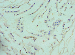 Immunohistochemistry of paraffin-embedded human prostate tissue using ARG2 Antibody at dilution of 1:100Rabbit anti-Human ARG2 Polyclonal Antibody