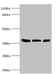 Western blot  | All lanes: ARG2 antibody at 5µg/ml  | Lane 1: Mouse liver tissue  | Lane 2: 293T whole cell lysate  | Lane 3: Mouse kidney tissue  | Secondary  | Goat polyclonal to rabbit IgG at 1/10000 dilution  | Predicted band size: 39 kDa  | Observed band size: 39 kDaRabbit anti-Human ARG2 Polyclonal Antibody
