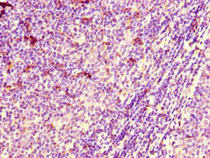 Immunohistochemistry of paraffin-embedded human lymph node tissue using ARIH2 Antibody at dilution of 1:100