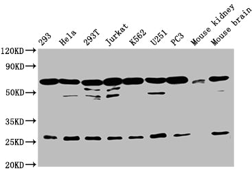 Western Blot | Positive WB detected in: 293 whole cell lysate, Hela whole cell lysate, 293T whole cell lysate, Jurkat whole cell lysate, K562 whole cell lysate, U251 whole cell lysate, PC-3 whole cell lysate, Mouse kidney tissue, Mouse brain tissue | All lanes: ARIH2 antibody at 1:2000 | Secondary | Goat polyclonal to rabbit IgG at 1/50000 dilution | Predicted band size: 58 kDa | Observed band size: 68 kDa